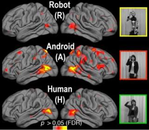 Reacción del cerebro.